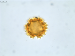 Pollen grain of Vernonia decaryana, R. Decary, 2799