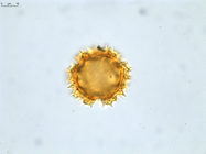 Pollen grain of Vernonia decaryana, R. Decary, 2799