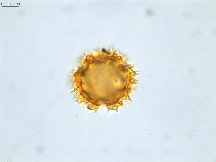Pollen grain of Vernonia decaryana, R. Decary, 2799