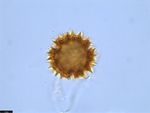 Pollen grain of Vernonia golungensis, Gossweiler, J., 5935
