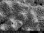 Pollen grain of Vernonia humillima, H. Humbert, 30129