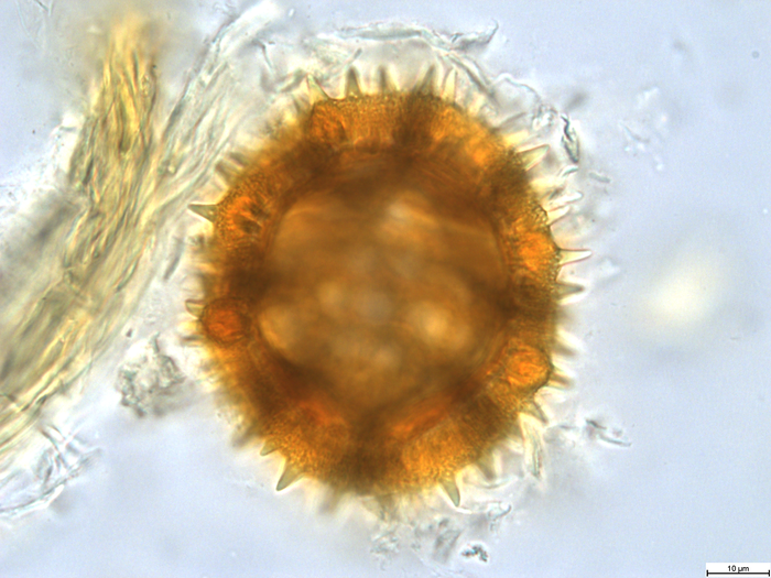 Pollen grain of Vernonia lualabaensis, Richards H.M., 5066
