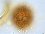 Pollen grain of Vernonia lualabaensis, Richards H.M., 5066