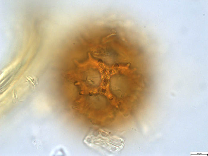 Pollen grain of Vernonia lualabaensis, Richards H.M., 5066
