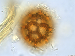 Pollen grain of Vernonia lualabaensis, Richards H.M., 5066