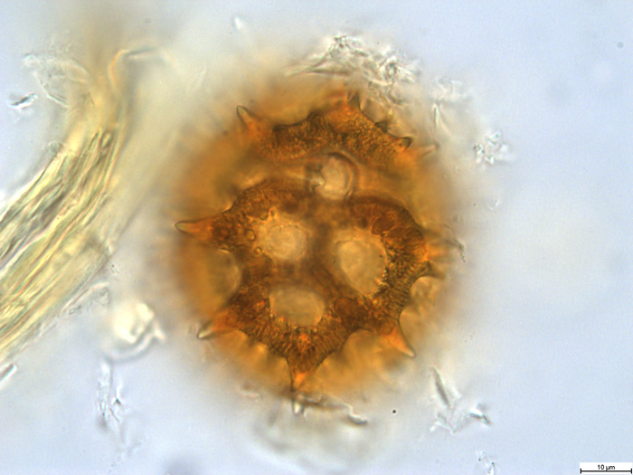 Pollen grain of Vernonia lualabaensis, Richards H.M., 5066