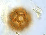 Pollen grain of Vernonia lualabaensis, Richards H.M., 5066