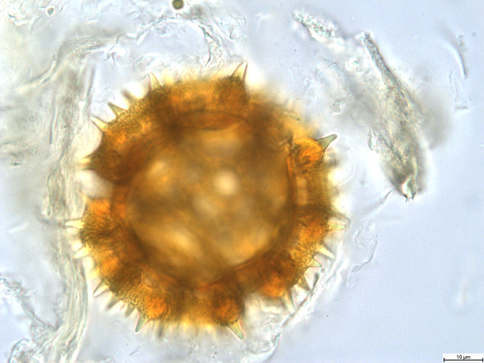 Pollen grain of Vernonia lualabaensis, Richards H.M., 5066