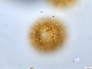 Pollen grain of Vernonia mumpullensis, Schmitz A., 3119