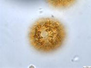 Pollen grain of Vernonia mumpullensis, Schmitz A., 3119