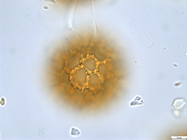 Pollen grain of Vernonia mumpullensis, Schmitz A., 3119