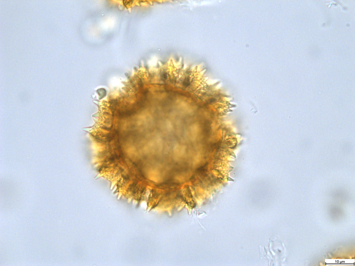 Pollen grain of Vernonia mumpullensis, Schmitz A., 3119