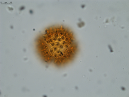 Pollen grain of Vernonia neocoursiana, G. Cours, 4700