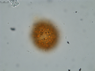 Pollen grain of Vernonia neocoursiana, G. Cours, 4700