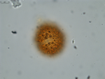 Pollen grain of Vernonia neocoursiana, G. Cours, 4700