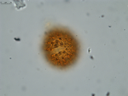 Pollen grain of Vernonia neocoursiana, G. Cours, 4700