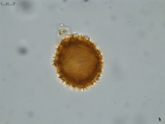 Pollen grain of Vernonia neocoursiana, G. Cours, 4700
