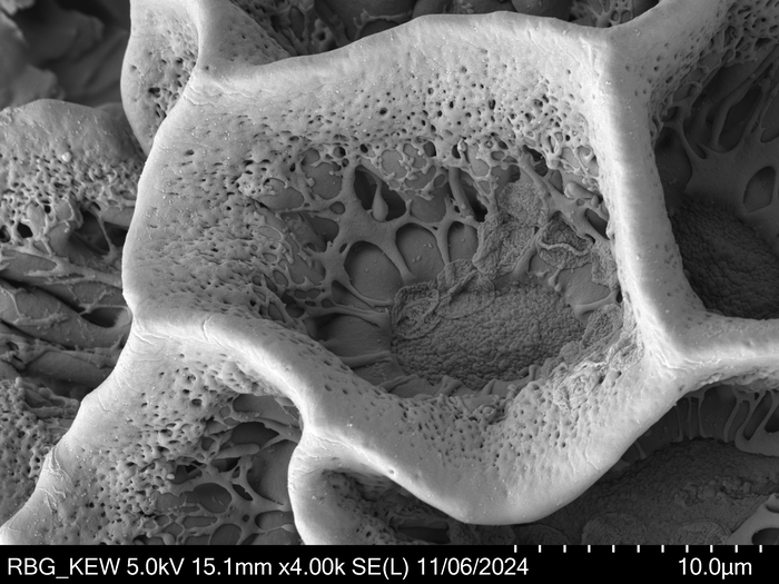 Pollen grain of Vernonia ornata, Gossweiler, J., 3313