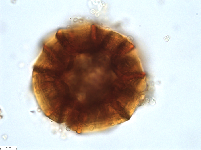 Pollen grain of Vernonia ornata, Gossweiler, J., 3313