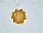 Pollen grain of Vernonia pellegrinii, H. Poisson, 547