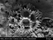 Pollen grain of Vernonia retifolia, Malaisse F., 7514