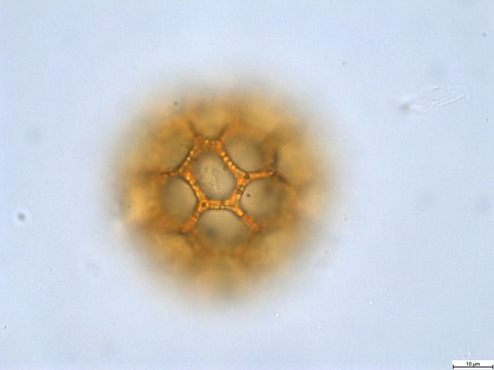 Pollen grain of Vernonia sapinii, Sapin A., S.N.