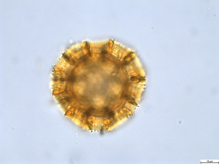Pollen grain of Vernonia sapinii, Sapin A., S.N.