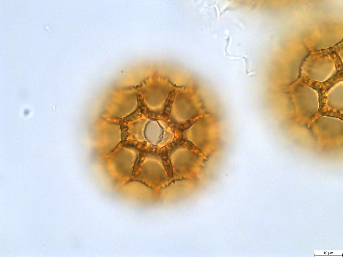 Pollen grain of Vernonia sapinii, Sapin A., S.N.