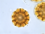 Pollen grain of Vernonia sapinii, Sapin A., S.N.