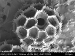 Pollen grain of Vernonia sapinii, Sapin A., S.N.