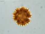 Pollen grain of Vernonia seyrigii, R. Decary , 8577