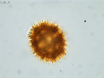 Pollen grain of Vernonia seyrigii, R. Decary , 8577