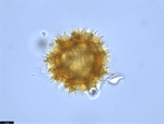 Pollen grain of Vernonia subplumosa, Gossweiler, J., 3771