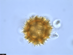 Pollen grain of Vernonia subplumosa, Gossweiler, J., 3771