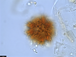 Pollen grain of Vernonia temnolepis, Exell, A.W., Mendonça, F.A., 2539