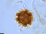 Pollen grain of Vernonia temnolepis, Exell, A.W., Mendonça, F.A., 2539