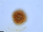 Pollen grain of Vernonia temnolepis, Exell, A.W., Mendonça, F.A., 2539