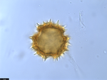 Pollen grain of Vernonia teucrioides, Teixeira, J.M.L.B., et al.,, 10625