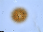 Pollen grain of Vernonia teucrioides, Teixeira, J.M.L.B., et al.,, 10625