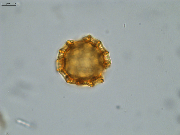 Pollen grain of Vernonia tropophila, L. Gautier, I. Luino, A.P. Rasolonjatovo, LG 6190