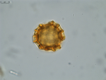 Pollen grain of Vernonia tropophila, L. Gautier, I. Luino, A.P. Rasolonjatovo, LG 6190