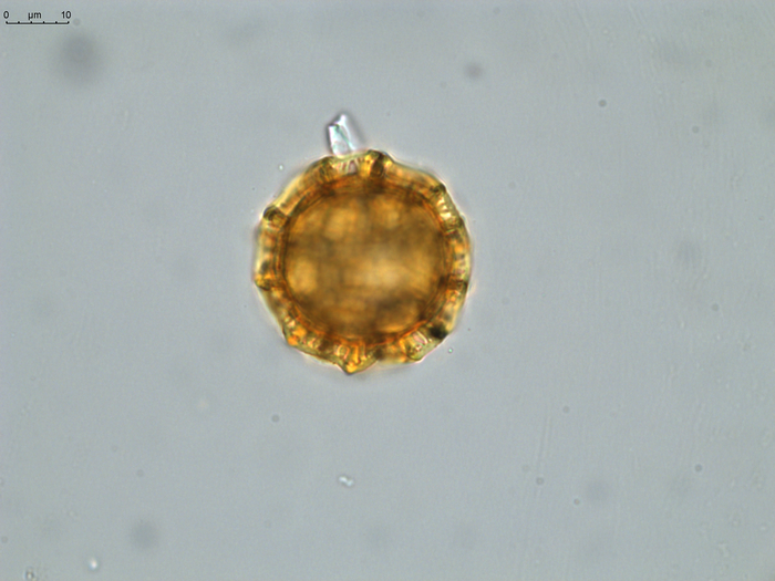 Pollen grain of Vernonia tropophila, L. Gautier, I. Luino, A.P. Rasolonjatovo, LG 6190