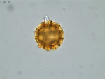 Pollen grain of Vernonia tropophila, L. Gautier, I. Luino, A.P. Rasolonjatovo, LG 6190