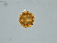 Pollen grain of Vernonia tropophila, L. Gautier, I. Luino, A.P. Rasolonjatovo, LG 6190