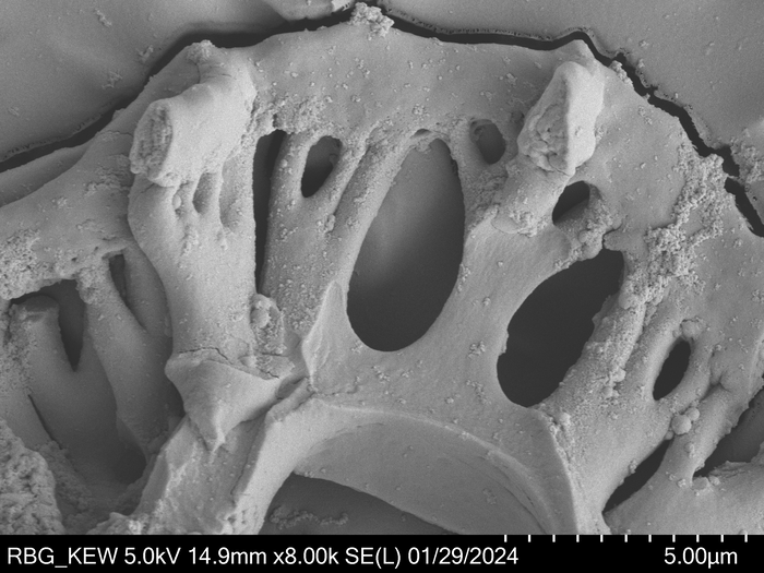 Pollen grain of Vernonia vohemarensis, H. Perrier de la Bâthie , 3151
