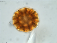 Pollen grain of Vernonia vohemarensis, H. Perrier de la Bâthie , 3151