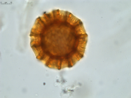 Pollen grain of Vernonia vohemarensis, H. Perrier de la Bâthie , 3151