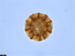 Pollen grain of Vernonia welwitschii, Exell, A.W., Mendonça, F.A., 2264