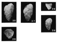 Reussella limboperforata Margerel, 1968