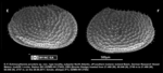 Female paratype of Echinocythereis jorunbrix Brandão & Karanovic, 2015 from original description